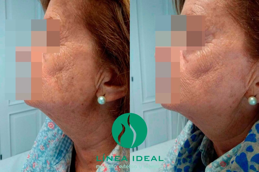 Clinic Results Gallery